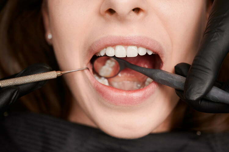 Bild zeigt Instrumente Zahnarzt in Mundhöhle